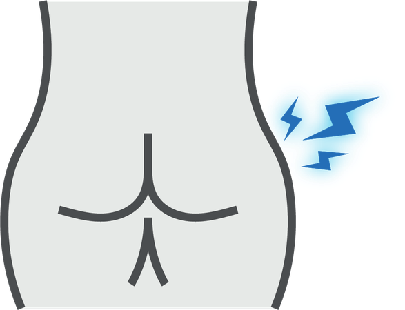 Anal Fissures