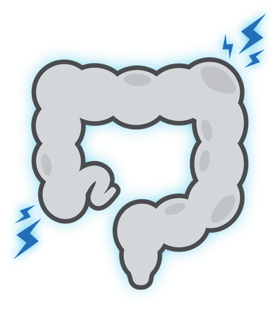Irritable Bowel Syndrome
