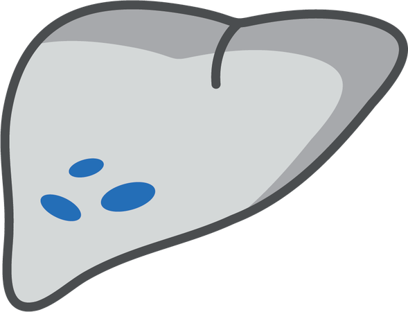 Fatty Liver Disease (MASLD)