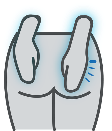 Hemorrhoids