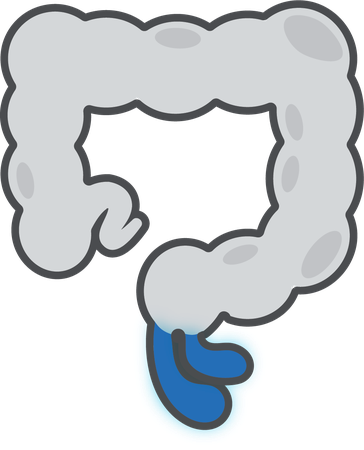Rectal Prolapse
