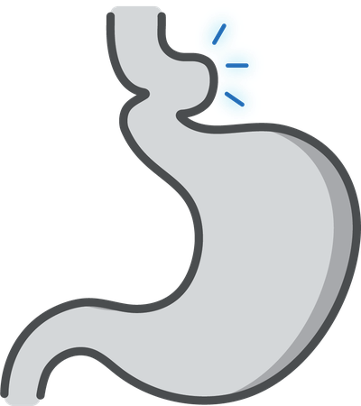 Hiatal Hernia